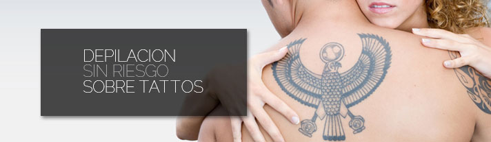 electrología tatuajes